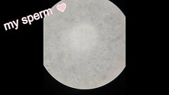 Sperm Observation 1 (No Abstinence) Thumb