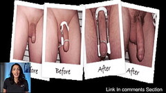Scientifically proven ways to increase penile length Thumb